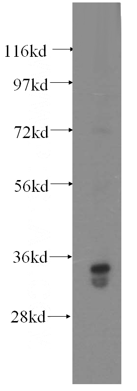 human liver tissue were subjected to SDS PAGE followed by western blot with Catalog No:111083(GLYATL1 antibody) at dilution of 1:500
