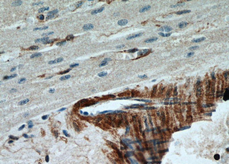 Immunohistochemical of paraffin-embedded human heart using Catalog No:109427(CNN2 antibody) at dilution of 1:50 (under 40x lens)