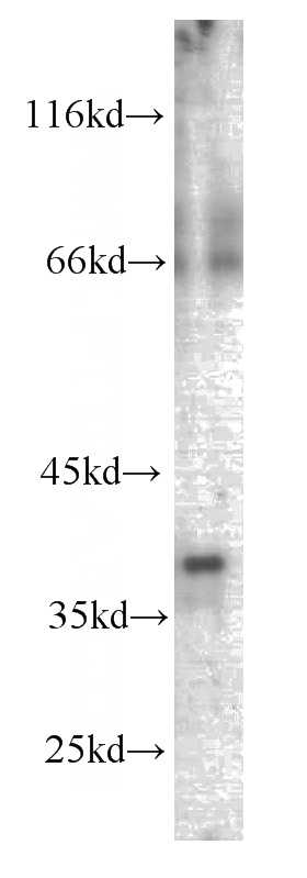 human brain tissue were subjected to SDS PAGE followed by western blot with Catalog No:107614(SYP antibody) at dilution of 1:500