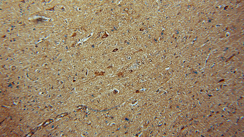 Immunohistochemical of paraffin-embedded human brain using Catalog No:111379(HDAC5-specific antibody) at dilution of 1:50 (under 10x lens)