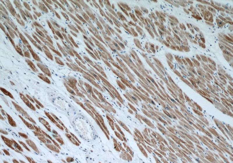 Immunohistochemical of paraffin-embedded human heart using Catalog No:109897(DES antibody) at dilution of 1:50 (under 10x lens)