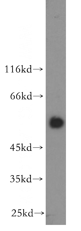 human heart tissue were subjected to SDS PAGE followed by western blot with Catalog No:111559(HSF4 antibody) at dilution of 1:300