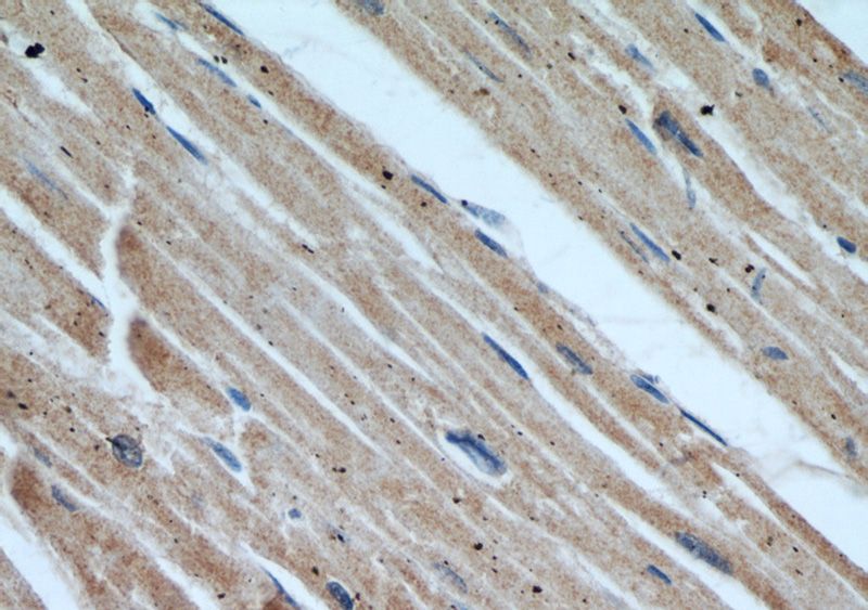 Immunohistochemical of paraffin-embedded human heart using Catalog No:109459(COPG2 antibody) at dilution of 1:50 (under 40x lens)