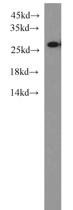 MCF7 cells were subjected to SDS PAGE followed by western blot with Catalog No:114376(PSMA6 antibody) at dilution of 1:1000
