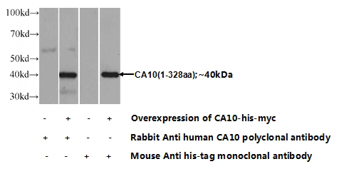 Transfected HEK-293 cells were subjected to SDS PAGE followed by western blot with Catalog No:108742(CA10 Antibody) at dilution of 1:700