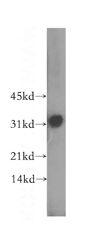 A549 cells were subjected to SDS PAGE followed by western blot with Catalog No:110284(ELMOD2 antibody) at dilution of 1:400
