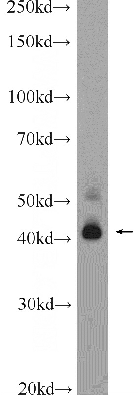 HeLa cells were subjected to SDS PAGE followed by western blot with Catalog No:116187(TMEM38B Antibody) at dilution of 1:600