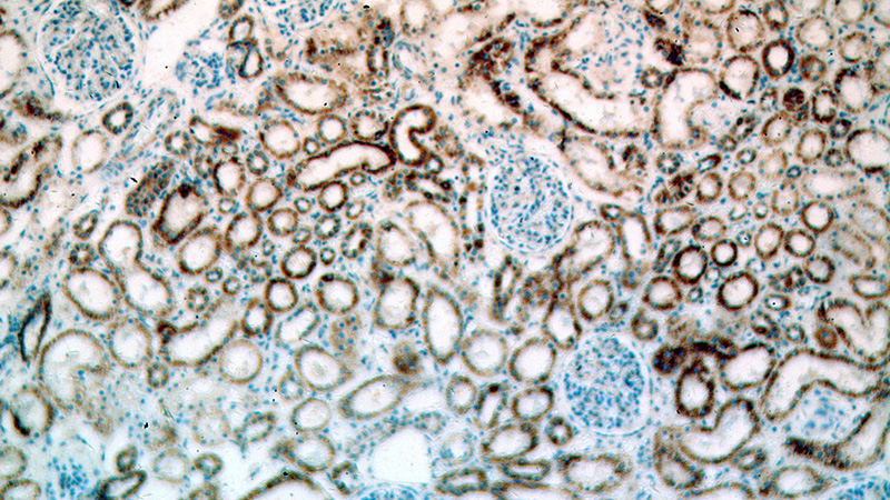 Immunohistochemical of paraffin-embedded human kidney using Catalog No:117061(SLC39A7 antibody) at dilution of 1:100 (under 10x lens)