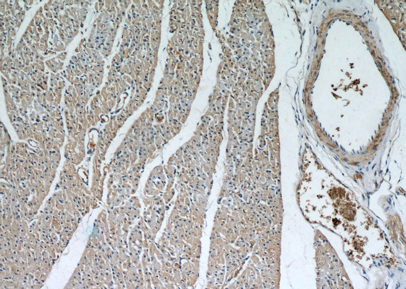 Immunohistochemical of paraffin-embedded human heart using Catalog No:112337(LRRC8C antibody) at dilution of 1:50 (under 10x lens)