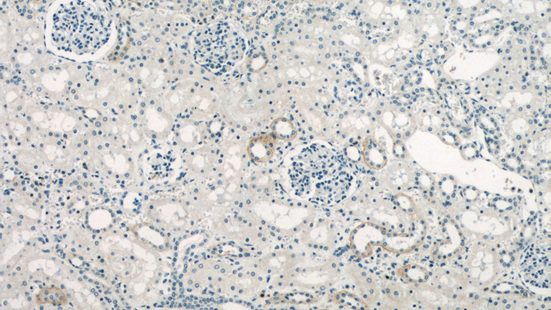 Immunohistochemistry of paraffin-embedded human kidney slide using Catalog No:113845(PRKACB Antibody) at dilution of 1:50