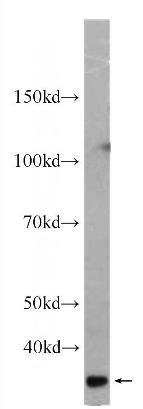 human heart tissue were subjected to SDS PAGE followed by western blot with Catalog No:107160(CLEC11A Antibody) at dilution of 1:1000