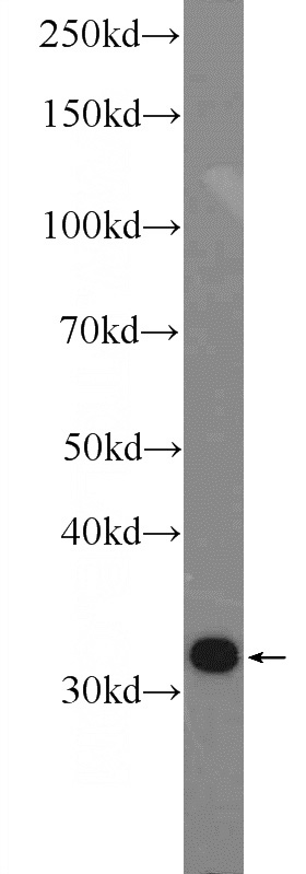 HL-60 cells were subjected to SDS PAGE followed by western blot with Catalog No:109388(CLIC1 Antibody) at dilution of 1:600