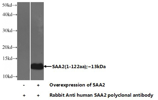 Transfected HEK-293 cells were subjected to SDS PAGE followed by western blot with Catalog No:115038(SAA2 Antibody) at dilution of 1:1000