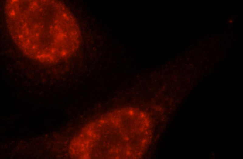 Immunofluorescent analysis of HepG2 cells, using DDX46 antibody Catalog No:109832 at 1:25 dilution and Rhodamine-labeled goat anti-rabbit IgG (red).
