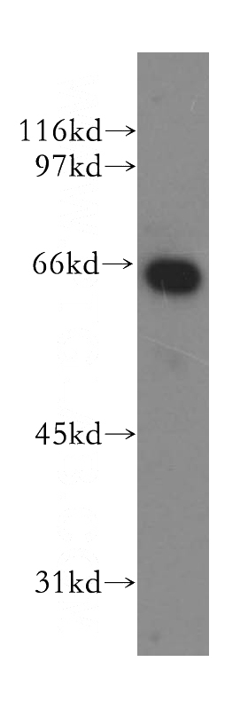 Raji cells were subjected to SDS PAGE followed by western blot with Catalog No:112077(KLF12 antibody) at dilution of 1:400