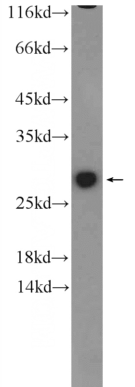 mouse ovary tissue were subjected to SDS PAGE followed by western blot with Catalog No:111185(GSTM1 antibody) at dilution of 1:500