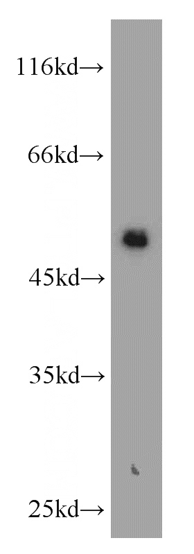 MCF7 cells were subjected to SDS PAGE followed by western blot with Catalog No:109813(KRT8 antibody) at dilution of 1:1500