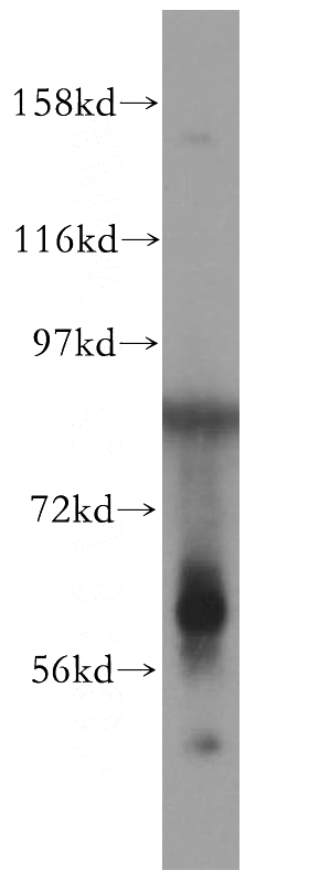 Raji cells were subjected to SDS PAGE followed by western blot with Catalog No:110323(ENPP1 antibody) at dilution of 1:1000