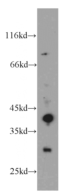 mouse skin tissue were subjected to SDS PAGE followed by western blot with Catalog No:107810(ABHD12B antibody) at dilution of 1:200