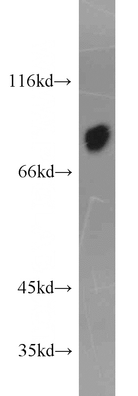 human blood tissue were subjected to SDS PAGE followed by western blot with Catalog No:107909(AFM antibody) at dilution of 1:1000