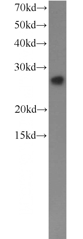 HepG2 cells were subjected to SDS PAGE followed by western blot with Catalog No:115444(SNAP23 antibody) at dilution of 1:1000