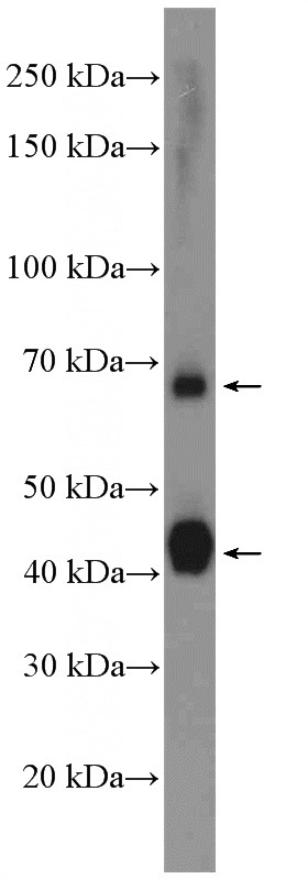 mouse brain tissue were subjected to SDS PAGE followed by western blot with Catalog No:108345(ATP1B2 Antibody) at dilution of 1:1000