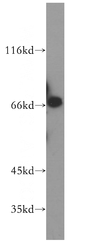 mouse testis tissue were subjected to SDS PAGE followed by western blot with Catalog No:112074(KLC2 antibody) at dilution of 1:800