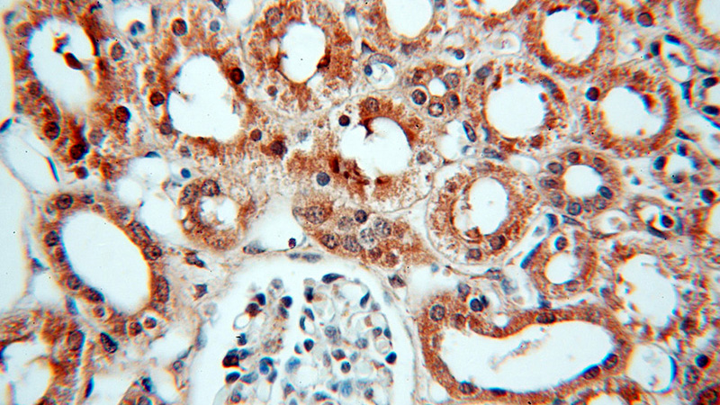 Immunohistochemical of paraffin-embedded human kidney using Catalog No:115392(SMN2 antibody) at dilution of 1:100 (under 40x lens)
