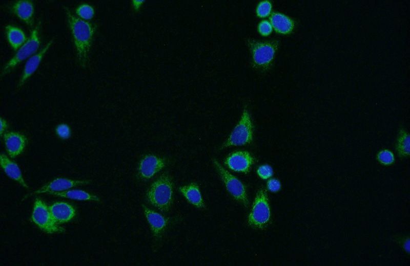 Immunofluorescent analysis of HepG2 cells using Catalog No:107963(ALDH1B1 Antibody) at dilution of 1:50 and Alexa Fluor 488-congugated AffiniPure Goat Anti-Rabbit IgG(H+L)