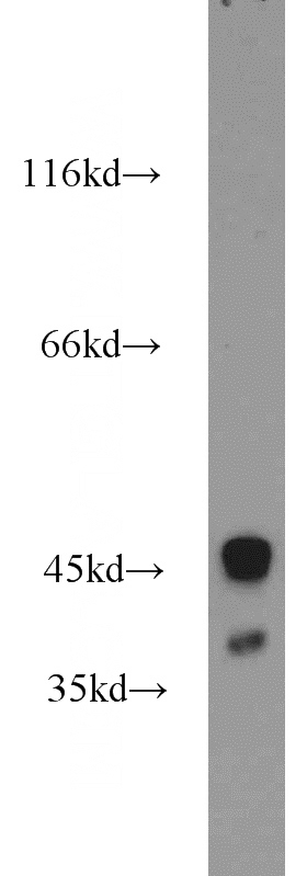 mouse brain tissue were subjected to SDS PAGE followed by western blot with Catalog No:117256(SLC30A3 antibody) at dilution of 1:1000