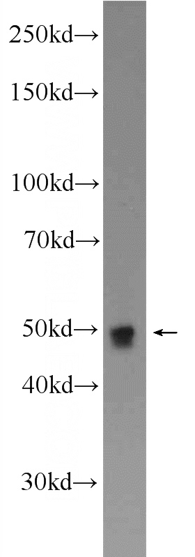 K-562 cells were subjected to SDS PAGE followed by western blot with Catalog No:109095(CDC23 Antibody) at dilution of 1:600