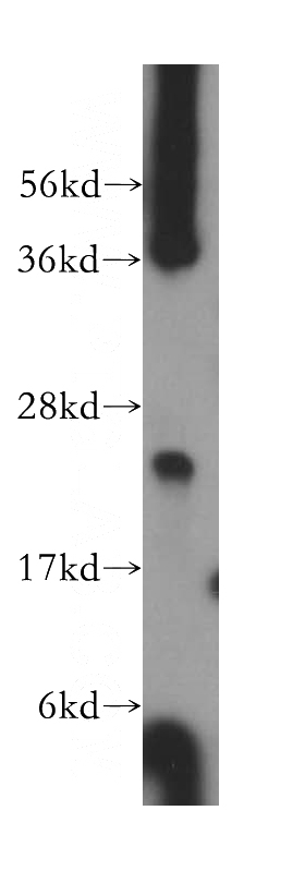 mouse testis tissue were subjected to SDS PAGE followed by western blot with Catalog No:108241(ARD1B antibody) at dilution of 1:500