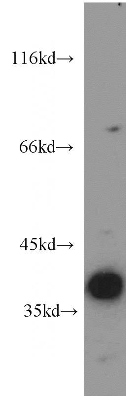 BxPC-3 cells were subjected to SDS PAGE followed by western blot with Catalog No:111143(GPS2 antibody) at dilution of 1:300
