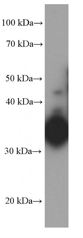 human liver tissue were subjected to SDS PAGE followed by western blot with Catalog No:107380(IL12B Antibody) at dilution of 1:1000