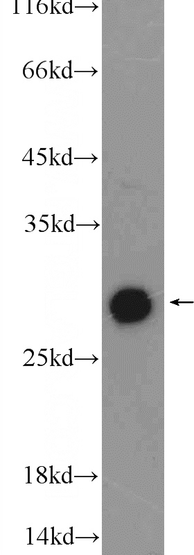 mouse brain tissue were subjected to SDS PAGE followed by western blot with Catalog No:110097(DNAJB6 Antibody) at dilution of 1:600