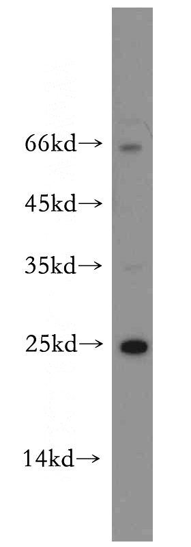MCF7 cells were subjected to SDS PAGE followed by western blot with Catalog No:114692(RERG antibody) at dilution of 1:1000