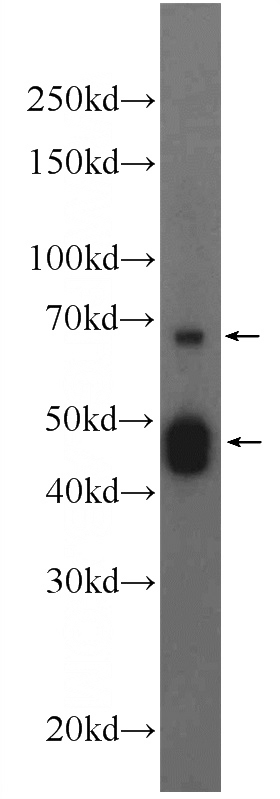 mouse liver tissue were subjected to SDS PAGE followed by western blot with Catalog No:109693(CYP2D6 Antibody) at dilution of 1:300