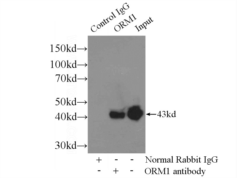 IP Result of anti-ORM1 (IP:Catalog No:113425, 3ug; Detection:Catalog No:113425 1:300) with human plasma tissue lysate 100ug.