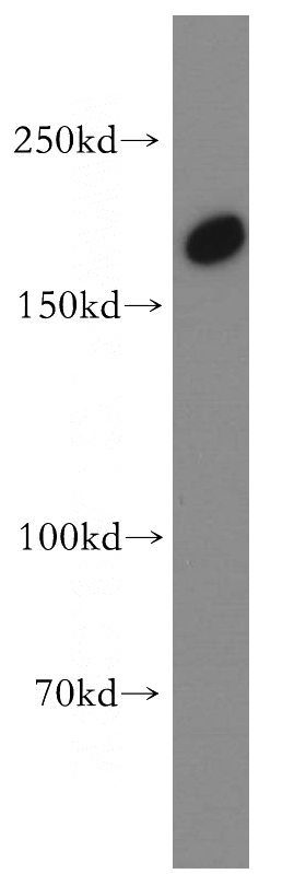 human skeletal muscle tissue were subjected to SDS PAGE followed by western blot with Catalog No:116494(TULP4 antibody) at dilution of 1:800