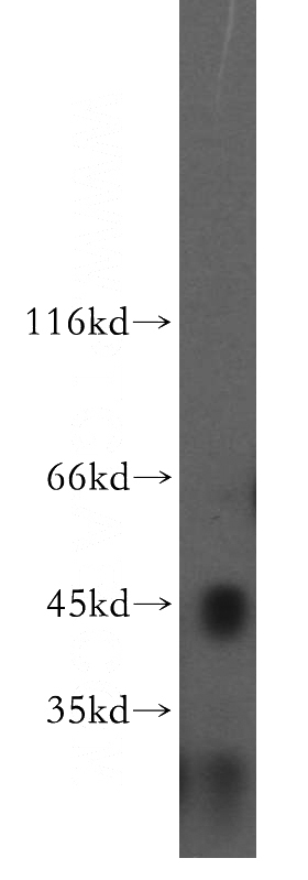 mouse liver tissue were subjected to SDS PAGE followed by western blot with Catalog No:116589(USP12 antibody) at dilution of 1:300