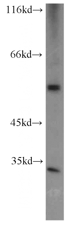 Jurkat cells were subjected to SDS PAGE followed by western blot with Catalog No:109199(CFLAR antibody) at dilution of 1:1000