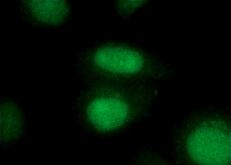 Immunofluorescent analysis of (10% Formaldehyde) fixed HepG2 cells using Catalog No:112041(KI67 Antibody) at dilution of 1:100 and Alexa Fluor 488-congugated AffiniPure Goat Anti-Rabbit IgG(H+L)
