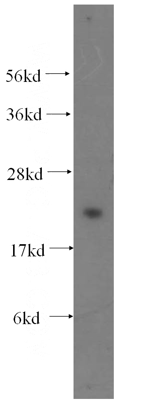 HeLa cells were subjected to SDS PAGE followed by western blot with Catalog No:113219(NPM3 antibody) at dilution of 1:500