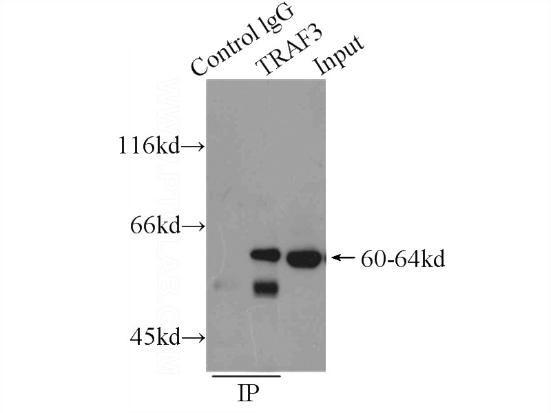IP Result of anti-TRAF3 (IP:Catalog No:116230, 4ug; Detection:Catalog No:116230 1:800) with Raji cells lysate 2000ug.