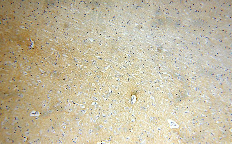 Immunohistochemical of paraffin-embedded human brain using Catalog No:111066(GPM6A antibody) at dilution of 1:50 (under 10x lens)