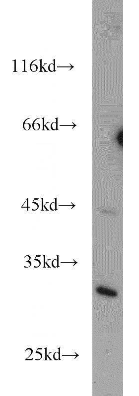 MCF7 cells were subjected to SDS PAGE followed by western blot with Catalog No:116675(UCK1 antibody) at dilution of 1:1000
