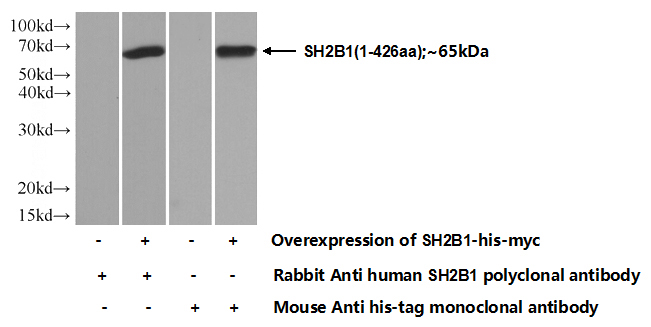 Transfected HEK-293 cells were subjected to SDS PAGE followed by western blot with Catalog No:115177(SH2B1 Antibody) at dilution of 1:700