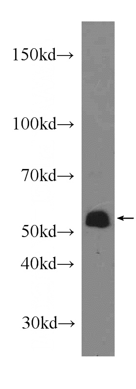 A549 cells were subjected to SDS PAGE followed by western blot with Catalog No:109482(COX10 antibody) at dilution of 1:300