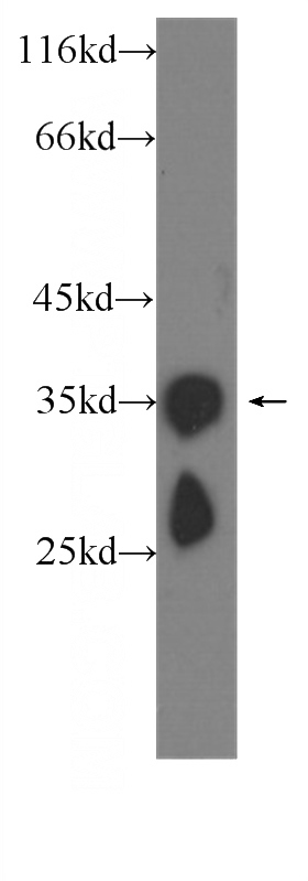 C6 cells were subjected to SDS PAGE followed by western blot with Catalog No:107178(CRYBB1 Antibody) at dilution of 1:1000