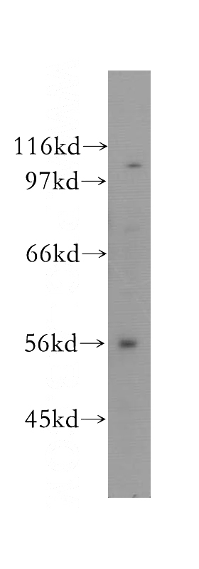 K-562 cells were subjected to SDS PAGE followed by western blot with Catalog No:109740(CUGBP2 antibody) at dilution of 1:300
